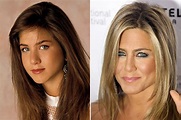 Celebrity Nose Jobs - Before & After - Mirror Online