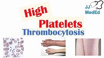 What Causes High Platelets (Thrombocytosis) | Approach to Causes ...