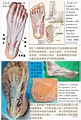 一文详解：足底跖筋膜炎的诊治策略 - 微医（挂号网）