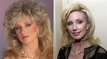 Morgan Fairchild Plastic Surgery Before and After - celebritysurgerypro.com