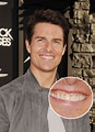 Tom Cruise's Middle Tooth — the Story Behind His Smile