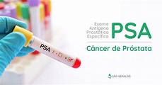 Exame Antígeno Prostático Específico (PSA) para Câncer de Próstata ...