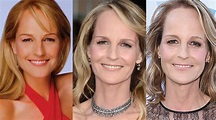 Helen Hunt Plastic Surgery Before and After Pictures 2024