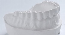 Yeso dental tipo I ventura snow soft. Madespa, distribuidor dental