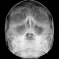 Radiografia Waters - Unimagem Radiografia Odontológica Curitiba