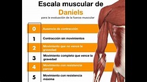 Valoración muscular basada en ESCALA DE DANIELS. miembros superiores e ...