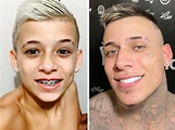 Antes e depois de MC Pedrinho viraliza: veja as mudanças