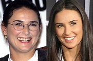 O “antes e depois” dos dentes dos famosos | CLAUDIA