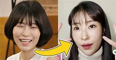 Comedian Lee Se Young Reveals Her New Face After Getting Surgery Due To ...