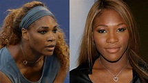 Serena Williams Plastic Surgery-Before And After 2024 - The Healthstore