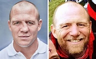 Mike Tindall finally gets his nose straightened out after breaking it ...