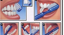 Five Easy Steps of Correct Brushing