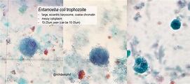 Entamoeba coli trophozoite on Microscopy - large, ... | GrepMed