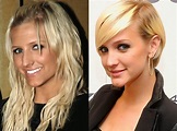 Ashlee Simpson Plastic Surgery Chin, Nose Job Before and After Pictures
