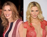 Take a Look at Brandi Glanville Before and after Plastic Surgery and ...