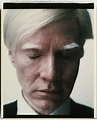 Did Andy Warhol Have Alopecia Totalis?