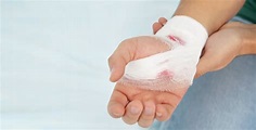 When does a cut needs stitches? | Walk-in Urgent Care Clinic Near Me