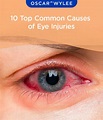 10 Top Common Causes of Eye Injuries