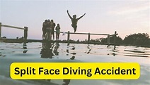 Split Face Diving Accident: Reasons and How to Avoid - Info Vogue