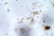 Entamoeba coli – Trophozoite – Parasitology