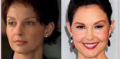 Ashley Judd Plastic Surgery Before And After Photos