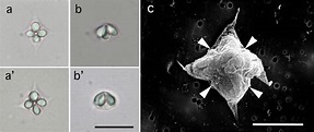 Microscopic views of the myxospores of Kudoa aburakarei n. sp. from ...
