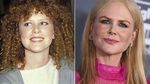 Bereits seit Jahren gehen Experten ... | Nicole Kidman: Was ist bloß ...