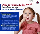 When to remove baby teeth, thereby making permanent teeth beautiful ...
