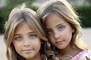 Die schönsten Zwillinge der Welt - freenet.de