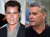 Ray Liotta Plastic Surgery – With Before And After Photos