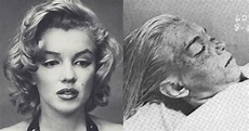 Marilyn Monroe’s Autopsy And What It Revealed About Her Death