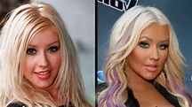 49 Celebrities Before and After Plastic Surgery - Клиника лазерной ...