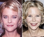Meg Ryan before and after plastic surgery – Celebrity plastic surgery ...