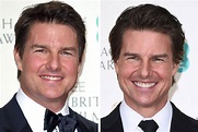 Tom Cruise, 'what has he done to his face?' - NZ Herald