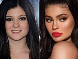 Kylie Jenner llega a los 25: Así ha evolucionado el rostro de la ...