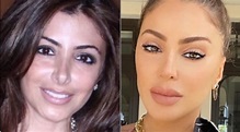PHOTO Larsa Pippen Before And After Plastic Surgery