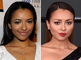 Kat Graham, Before and After | Kat graham, Beauty, Lip injections