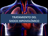Shock hipovolémico: que es y como realiza el tratamiento