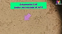 E.Coli under microscope. Entamoeba Coli Parasite in stool microscopy.E ...