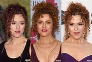 Bernadette Peters Plastic Surgery Before And After Photos