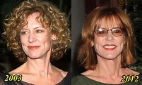 Christine Lahti Plastic Surgery Facelift Before And After Photo