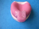 Cubetas de impresión - Apuntes de prótesis dental