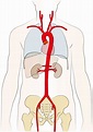 Aortenchirurgie - Erkrankungen & Therapien | Herzchirurgie Uniklinik Köln