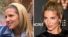 Elsa Pataky | El antes y el después de las rinoplastias de las...