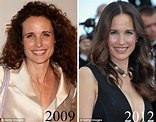 Andie MacDowell Plastic Surgery Before And After Photos