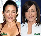 Patricia Heaton Plastic Surgery Before and After | Plastic surgery ...