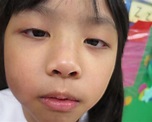 【女童虐斃】5歲女臨臨死前相片 《傳真社》揭學校曾揭發傷痕及記錄 | 生活熱話
