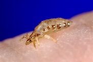 Body Lice | symptoms, diagnosis, treatment, pictures, home remedies