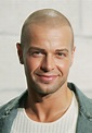 Joey Lawrence Hair Transplant: A Detailed Examination - Cosmeticium