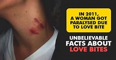 You Would Not Be Aware Of These Facts About Love Bites. Read Only If ...